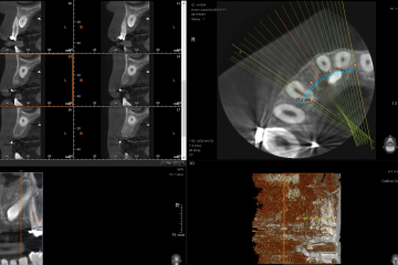 3D CBCT 